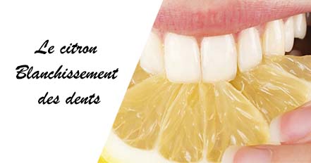 citron blanchissement dents